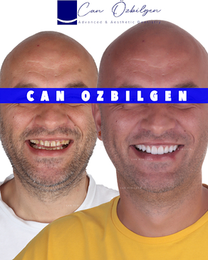 Slider image (7) Can Ozbilgen Advanced & Aesthetic Dentistry